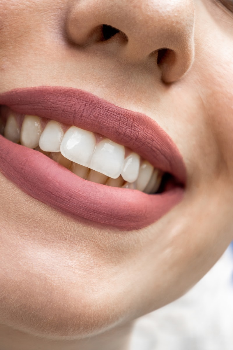 Cosmetic Dentistry