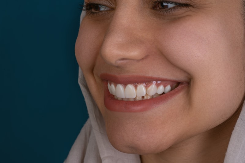 Porcelain Veneers